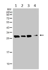 Western blot - Anti-SBDS antibody (AB154222)
