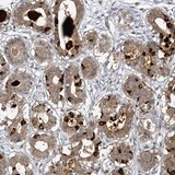 Immunohistochemistry (Formalin/PFA-fixed paraffin-embedded sections) - Anti-SBEM antibody (AB122530)