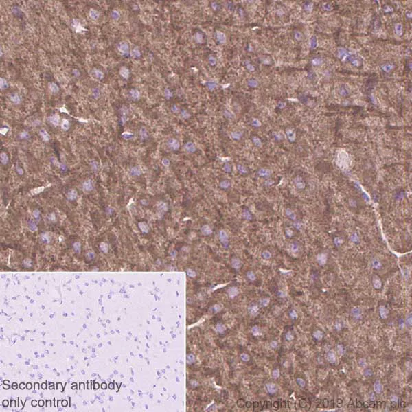 Immunohistochemistry (Formalin/PFA-fixed paraffin-embedded sections) - Anti-Sbf1 antibody [EPR12567] (AB181106)