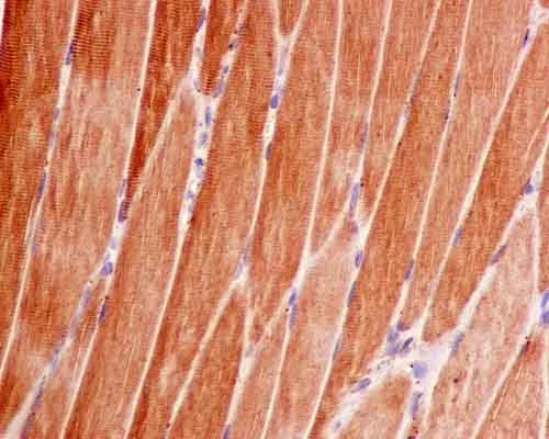 Immunohistochemistry (Formalin/PFA-fixed paraffin-embedded sections) - Anti-Sbf1 antibody [EPR12567] (AB181106)