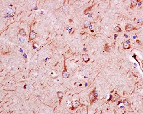 Immunohistochemistry (Formalin/PFA-fixed paraffin-embedded sections) - Anti-Sbf1 antibody [EPR12567] (AB181106)