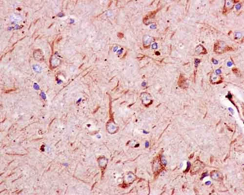 Immunohistochemistry (Formalin/PFA-fixed paraffin-embedded sections) - Anti-Sbf1 antibody [EPR12567] (AB181106)