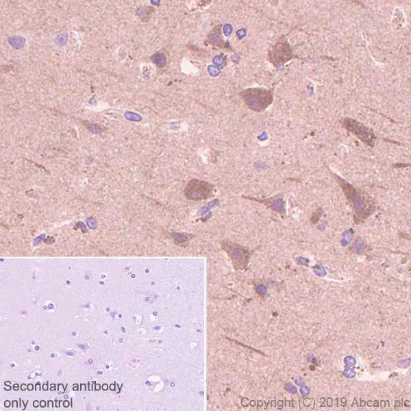 Immunohistochemistry (Formalin/PFA-fixed paraffin-embedded sections) - Anti-Sbf1 antibody [EPR12567] - BSA and Azide free (AB250353)