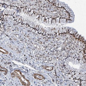 Immunohistochemistry (Formalin/PFA-fixed paraffin-embedded sections) - Anti-SBF2 antibody (AB151110), expandable thumbnail