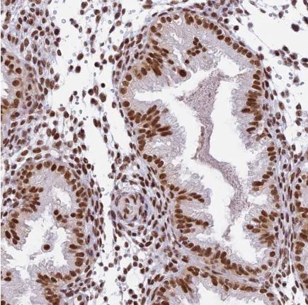 Immunohistochemistry (Formalin/PFA-fixed paraffin-embedded sections) - Anti-SBNO1 antibody (AB122789)
