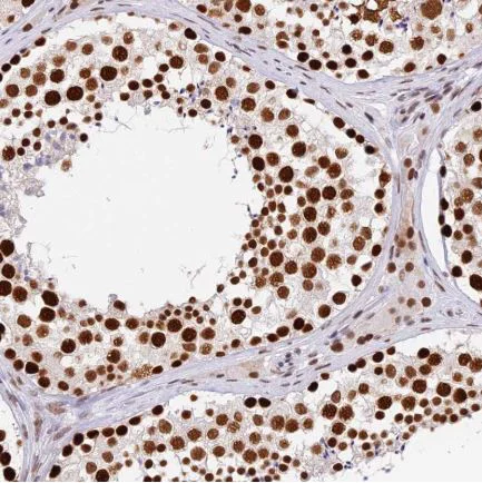 Immunohistochemistry (Formalin/PFA-fixed paraffin-embedded sections) - Anti-SBNO1 antibody (AB122789)