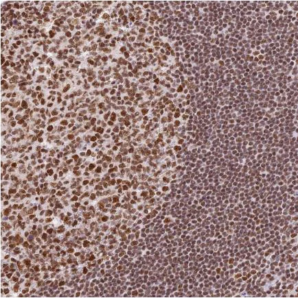 Immunohistochemistry (Formalin/PFA-fixed paraffin-embedded sections) - Anti-SBNO1 antibody (AB122789)