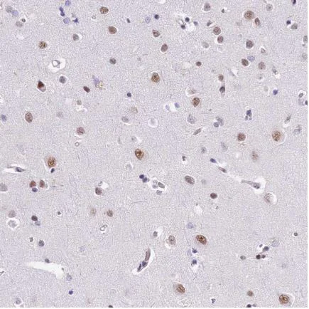 Immunohistochemistry (Formalin/PFA-fixed paraffin-embedded sections) - Anti-SBNO1 antibody (AB122789)