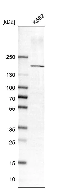 Western blot - Anti-SBNO1 antibody (AB122789)
