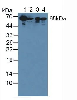 Western blot - Anti-SBSN antibody (AB232771)