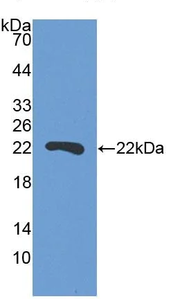 Western blot - Anti-SBSN antibody (AB232771)