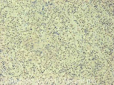 Immunohistochemistry (Formalin/PFA-fixed paraffin-embedded sections) - Anti-SC35 antibody (AB28428)