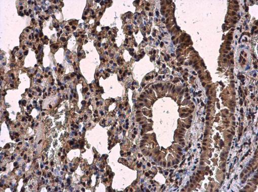 Immunohistochemistry (Formalin/PFA-fixed paraffin-embedded sections) - Anti-SC35 antibody - N-terminal (AB229473)