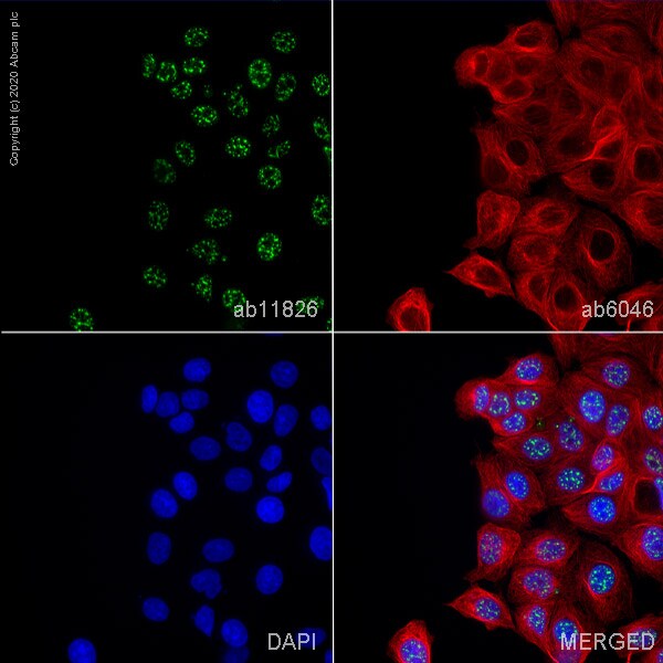 Immunocytochemistry - Anti-SC35 antibody [SC-35] - BSA and Azide free (AB264431)