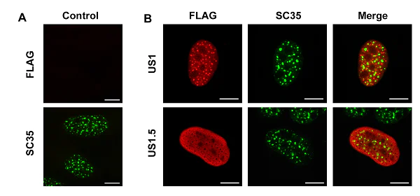 Immunocytochemistry/ Immunofluorescence - Anti-SC35 antibody [SC-35] - Nuclear Speckle Marker (AB11826)