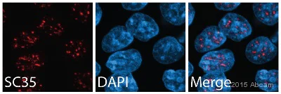 Immunocytochemistry/ Immunofluorescence - Anti-SC35 antibody [SC-35] - Nuclear Speckle Marker (AB11826)