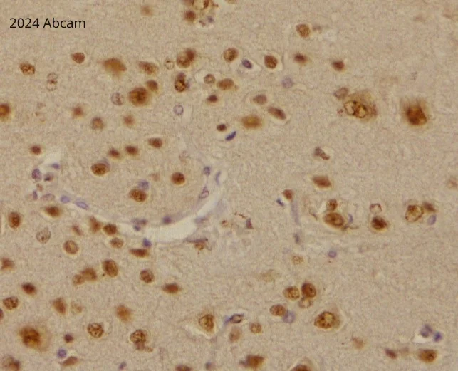 Immunohistochemistry (Formalin/PFA-fixed paraffin-embedded sections) - Anti-SC35 antibody [SC-35] - Nuclear Speckle Marker (AB11826)