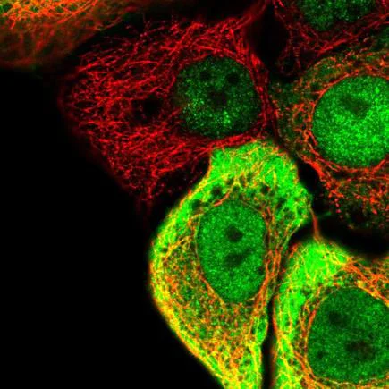 Immunocytochemistry/ Immunofluorescence - Anti-SC5DL antibody (AB221764)