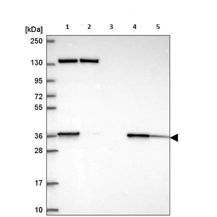 Western blot - Anti-SC5DL antibody (AB221764)