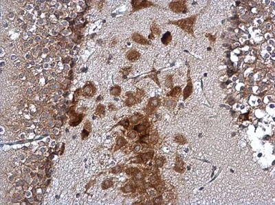 Immunohistochemistry (Formalin/PFA-fixed paraffin-embedded sections) - Anti-SCA2 antibody (AB227922)