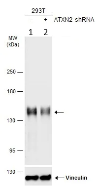 Western blot - Anti-SCA2 antibody (AB227922)