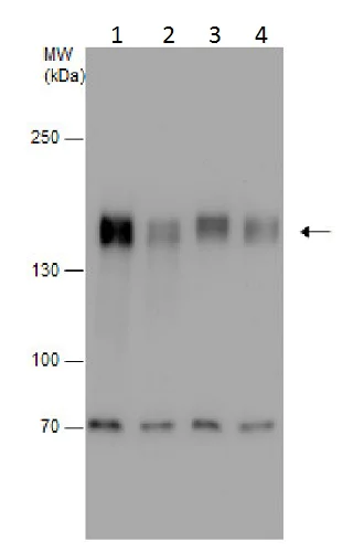 Western blot - Anti-SCA2 antibody (AB227922)