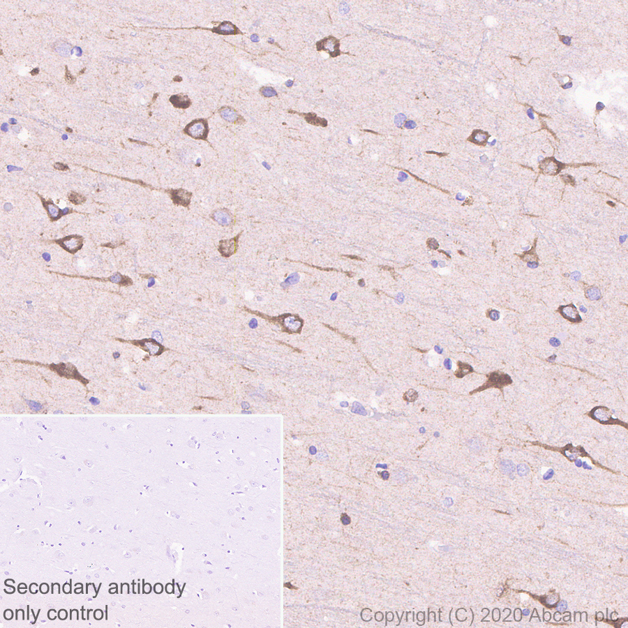 Immunohistochemistry (Formalin/PFA-fixed paraffin-embedded sections) - Anti-SCA2 antibody [EPR23630-49] (AB254362), expandable thumbnail