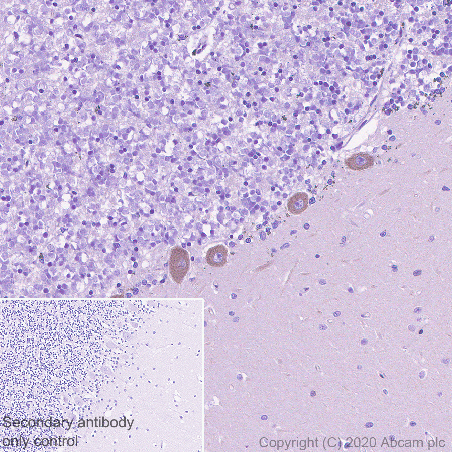 Immunohistochemistry (Formalin/PFA-fixed paraffin-embedded sections) - Anti-SCA2 antibody [EPR23630-49] (ab254362), expandable thumbnail