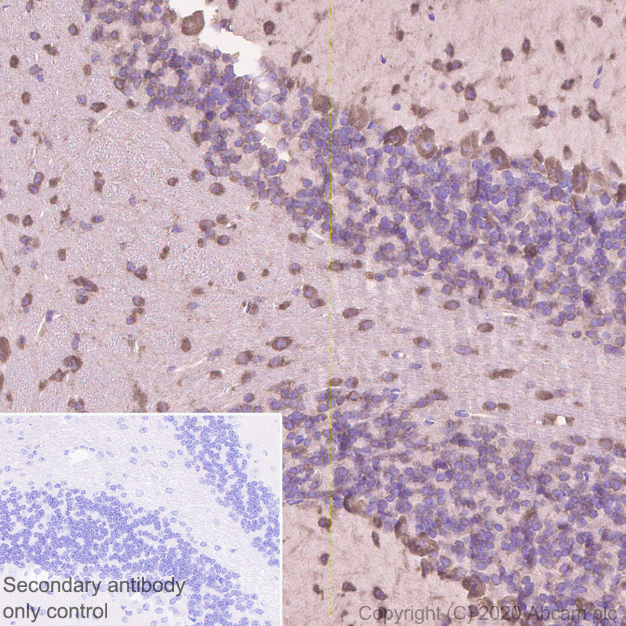 Immunohistochemistry (Formalin/PFA-fixed paraffin-embedded sections) - Anti-SCA2 antibody [EPR23630-49] (ab254362), expandable thumbnail