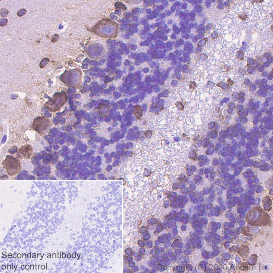 Immunohistochemistry (Formalin/PFA-fixed paraffin-embedded sections) - Anti-SCA2 antibody [EPR23630-49] (ab254362), expandable thumbnail