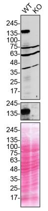 Western blot - Anti-SCA2 antibody [EPR23630-49] (AB254362), expandable thumbnail