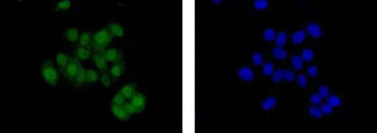 Immunocytochemistry/ Immunofluorescence - Anti-SCAI antibody [EPR4128] - BSA and Azide free (AB247960)