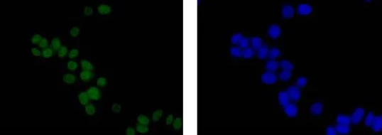 Immunocytochemistry/ Immunofluorescence - Anti-SCAI antibody [EPR4128] - BSA and Azide free (AB247960)