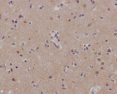 Immunohistochemistry (Formalin/PFA-fixed paraffin-embedded sections) - Anti-SCAI antibody [EPR4128] - BSA and Azide free (ab247960), expandable thumbnail