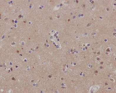 Immunohistochemistry (Formalin/PFA-fixed paraffin-embedded sections) - Anti-SCAI antibody [EPR4128] - BSA and Azide free (AB247960)