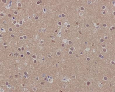 Immunohistochemistry (Formalin/PFA-fixed paraffin-embedded sections) - Anti-SCAI antibody [EPR4128] - BSA and Azide free (AB247960), expandable thumbnail