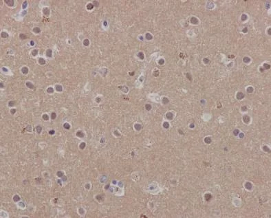Immunohistochemistry (Formalin/PFA-fixed paraffin-embedded sections) - Anti-SCAI antibody [EPR4128] - BSA and Azide free (AB247960)
