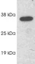Western blot - Anti-SCAMP1 antibody (AB3430)