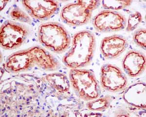 Immunohistochemistry (Formalin/PFA-fixed paraffin-embedded sections) - Anti-SCAMP2/SC2 antibody [EPR10185] (AB154181)