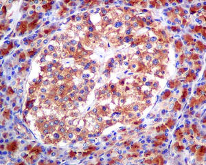 Immunohistochemistry (Formalin/PFA-fixed paraffin-embedded sections) - Anti-SCAMP2/SC2 antibody [EPR10185] - BSA and Azide free (AB249081)