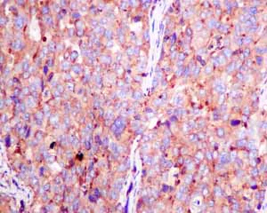 Immunohistochemistry (Formalin/PFA-fixed paraffin-embedded sections) - Anti-SCAMP2/SC2 antibody [EPR10185] - BSA and Azide free (AB249081)