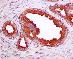 Immunohistochemistry (Formalin/PFA-fixed paraffin-embedded sections) - Anti-SCAMP2/SC2 antibody [EPR10185] - BSA and Azide free (AB249081)