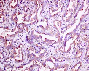 Immunohistochemistry (Formalin/PFA-fixed paraffin-embedded sections) - Anti-SCAMP2/SC2 antibody [EPR10185] - BSA and Azide free (AB249081)