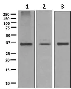 Western blot - Anti-SCAMP2/SC2 antibody [EPR10185] - BSA and Azide free (AB249081)
