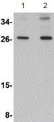 Western blot - Anti-SCAMP4 antibody (AB106447)