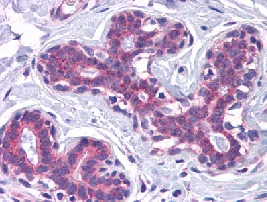 Immunohistochemistry (Formalin/PFA-fixed paraffin-embedded sections) - Anti-SCAMP4 antibody (AB113651)