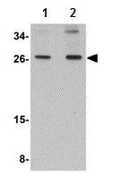 Western blot - Anti-SCAMP4 antibody (AB113651)