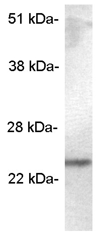Western blot - Anti-SCAMP5 antibody (AB3432)