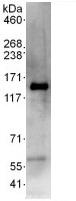 Immunoprecipitation - Anti-SCAP antibody (AB125186)