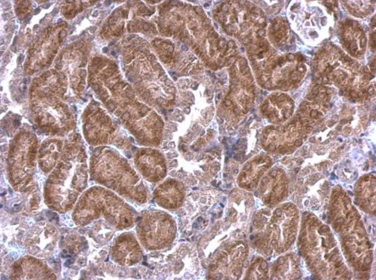 Immunohistochemistry (Formalin/PFA-fixed paraffin-embedded sections) - Anti-SCAP antibody (AB153933)